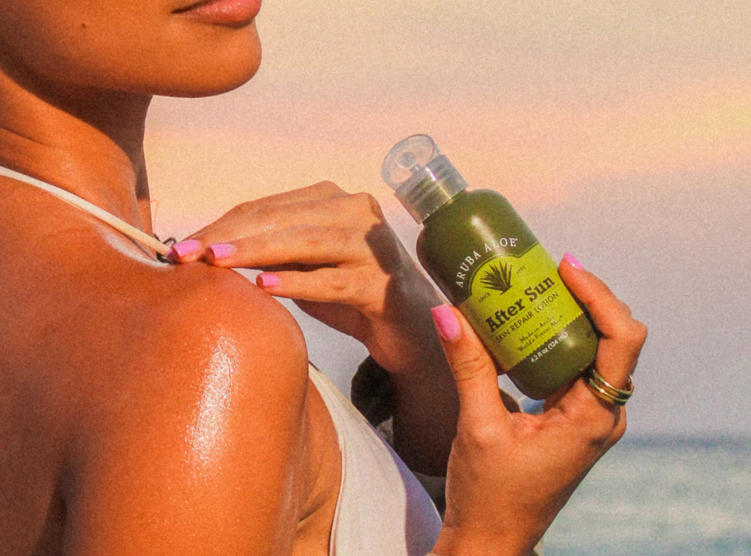 Aruba Aloe After Sun Skin Repair Lotion