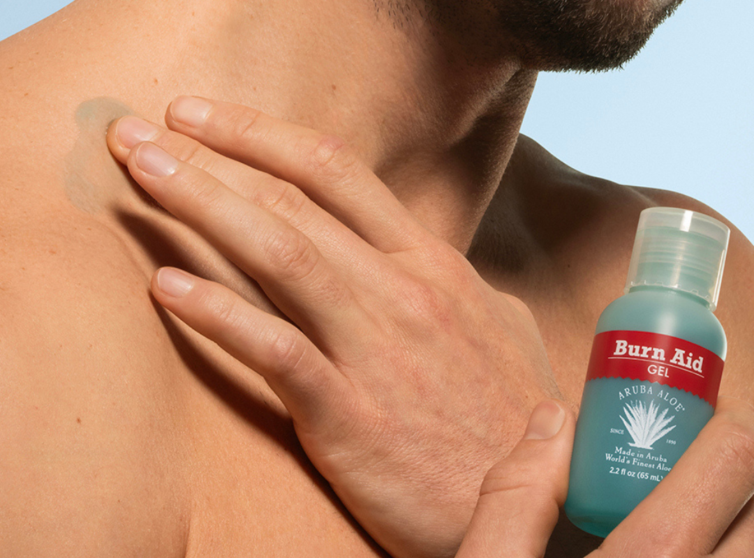 Aruba Aloe Burn Aid Gel